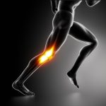 Running sore knee